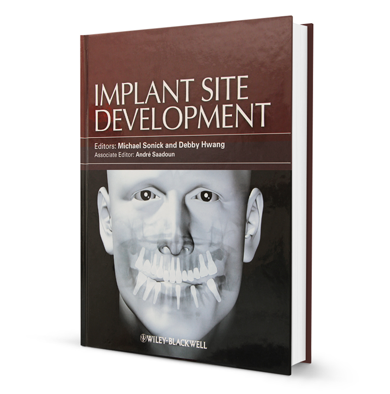 Implant Development